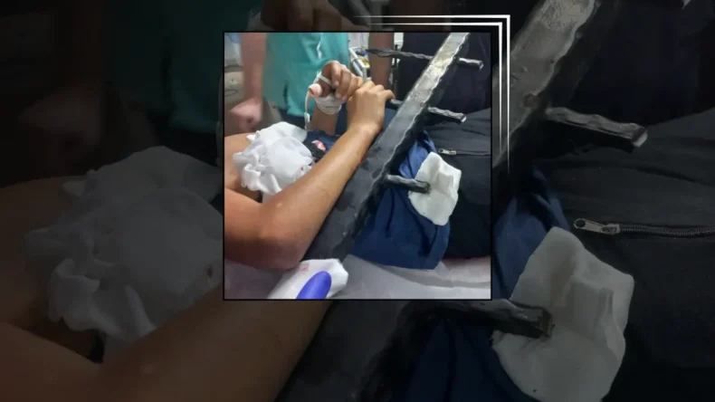 İzmir’de ağaçtan düşen çocuğa demir çit saplandı